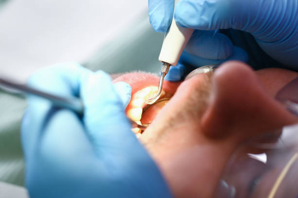 Best Emergency Broken Tooth Repair in Augusta, KY