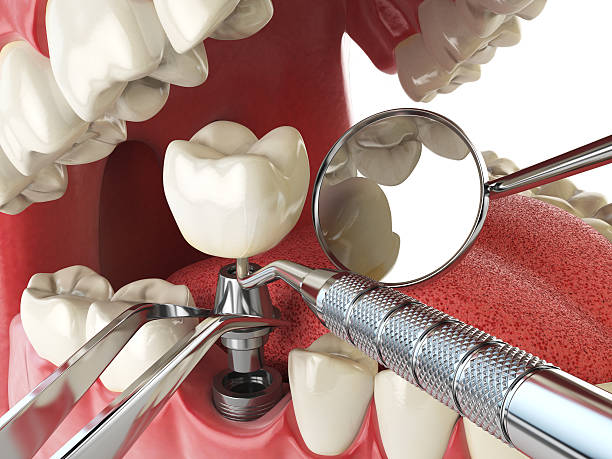 Professional Emergency Dentist in KY